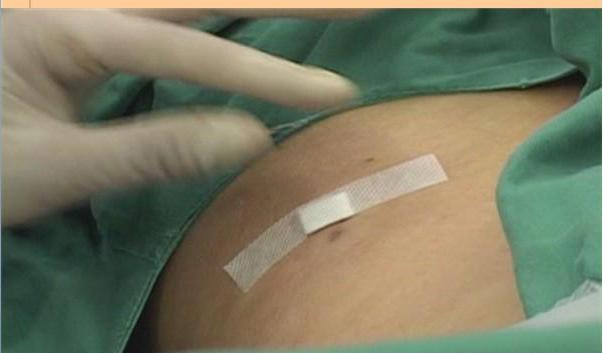 腰椎间盘突出能够恢复吗,腰椎间盘突出能够完全治好吗