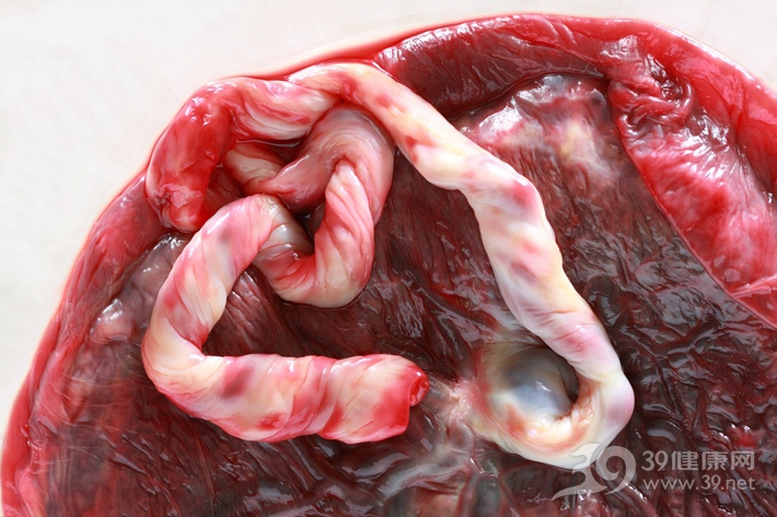 胎盘胶囊与紫河车胶囊有区别吗,中医为什么把胎盘称为紫河车