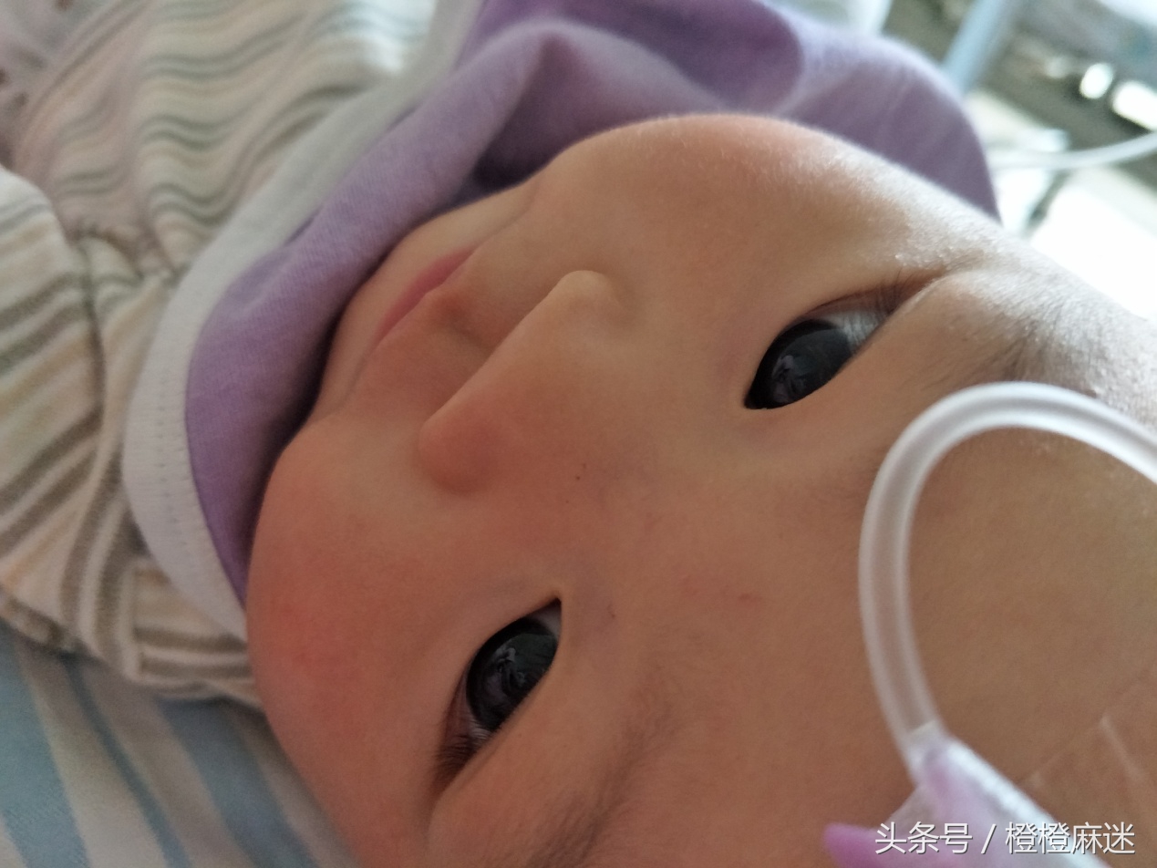 8个月宝宝尿路感染最快自愈法,四个月的宝宝尿路感染怎么处理