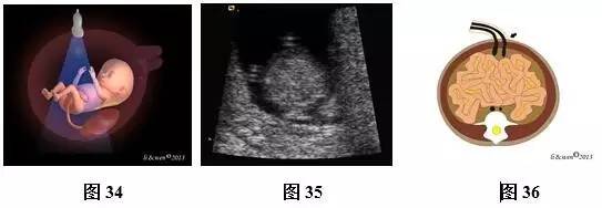 孕26周进行胎儿超声心动图检查,孕11-14周胎儿超声检测报告