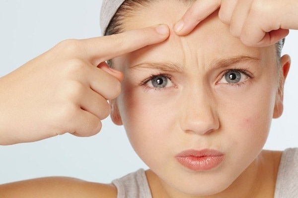 脸部痘痘分布图原因,面部起痘痘位置和原因图片