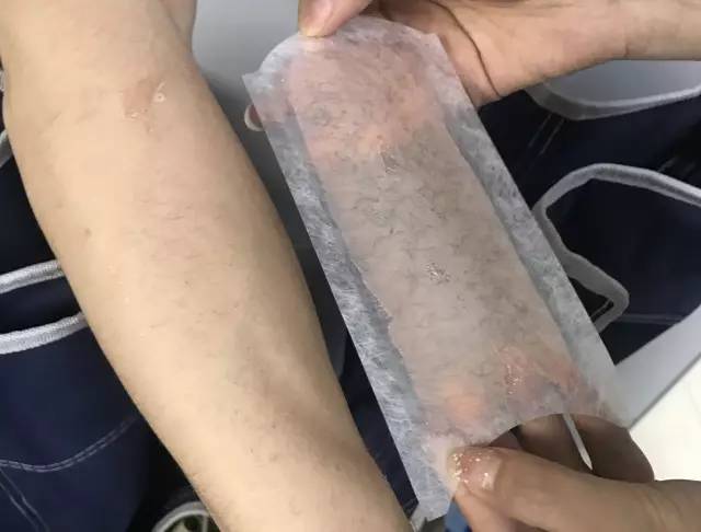 速速围观,帅哥亲自上阵被“撕扯”,告诉你哪款脱毛产品最有效!