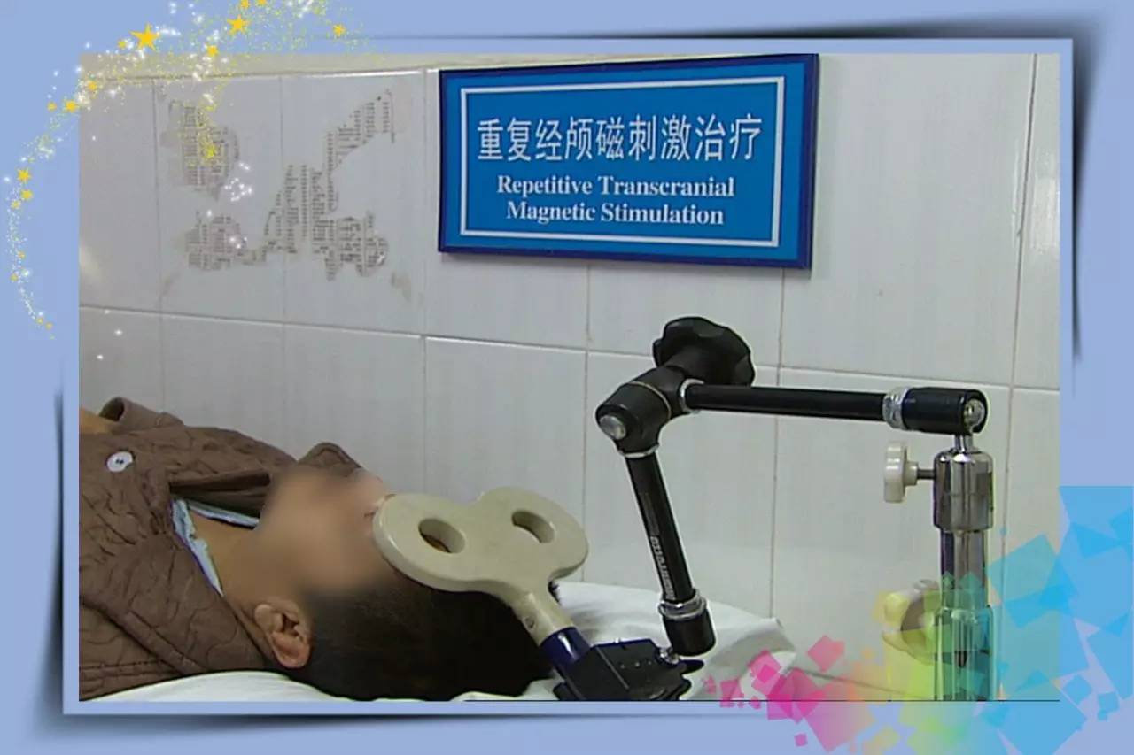 经颅重复低频磁刺激治疗,经颅重复磁刺激治疗的视频