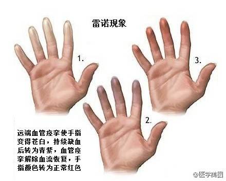 爸妈说你“二天”一定要得的这种病，到底是个啥子病？