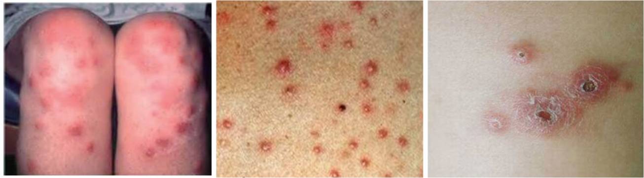 爸妈说你“二天”一定要得的这种病，到底是个啥子病？