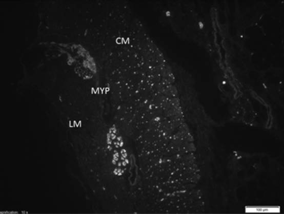 内镜下肌切开术手术步骤,肌肉活检最新技术
