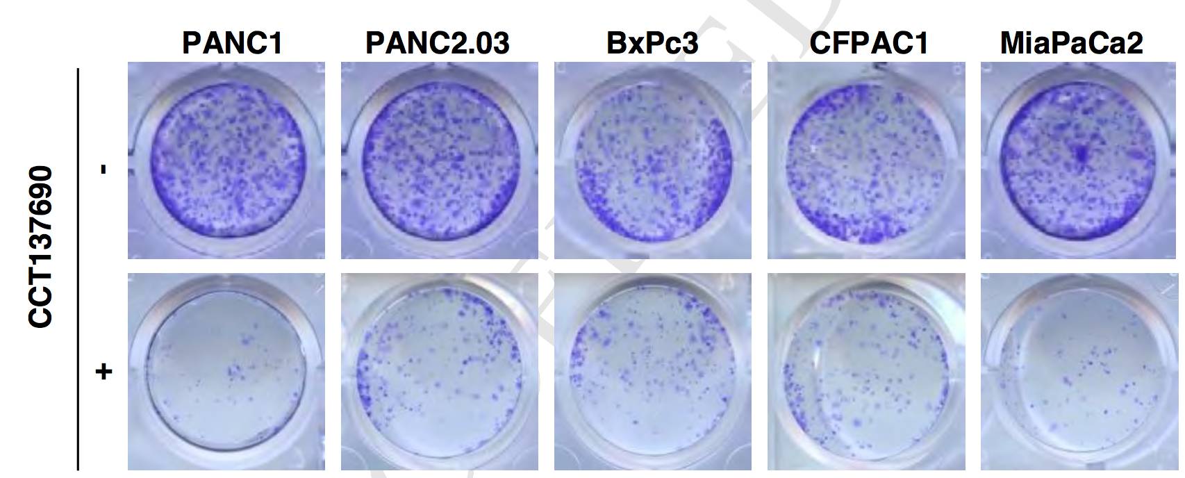 意义非凡！广州医科大学唐道林教授团队发现治疗胰腺癌的新药物和新机制｜科学大发现