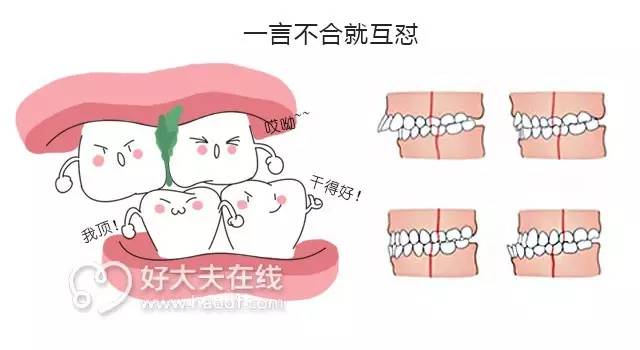 总塞牙怎么办,经常塞牙造成坏牙