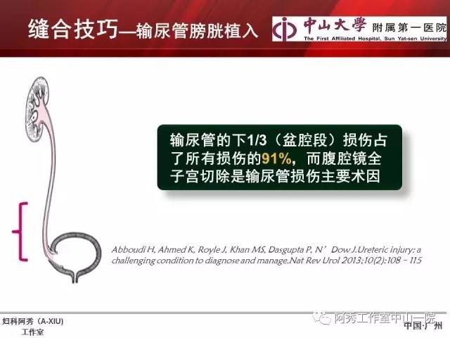 妇科腹腔镜下常用缝合技巧