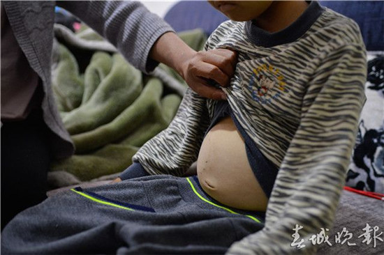 霍奇金淋巴瘤彻底治愈需要多少钱,9岁男孩白血病治疗费用