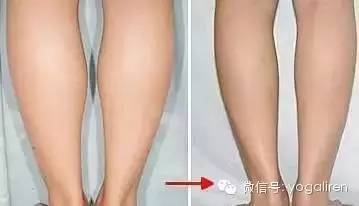 不同的腿型的瘦腿方法,适合各种腿型的瘦腿方法