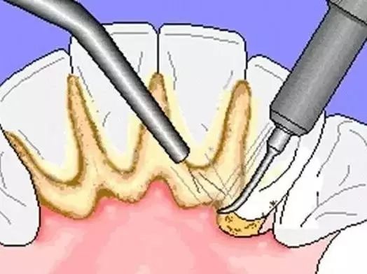 「爱牙日」牙龈出血、口腔异味、牙龈发炎……广东省中医院口腔科的这些“明星制剂”或能帮到您
