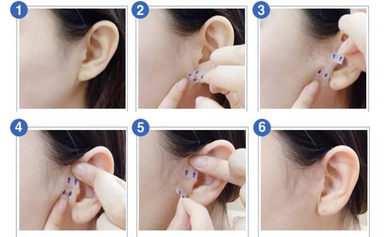 医学瘦脸的方法有哪些不打针,瘦脸除了打针还可以有什么方法