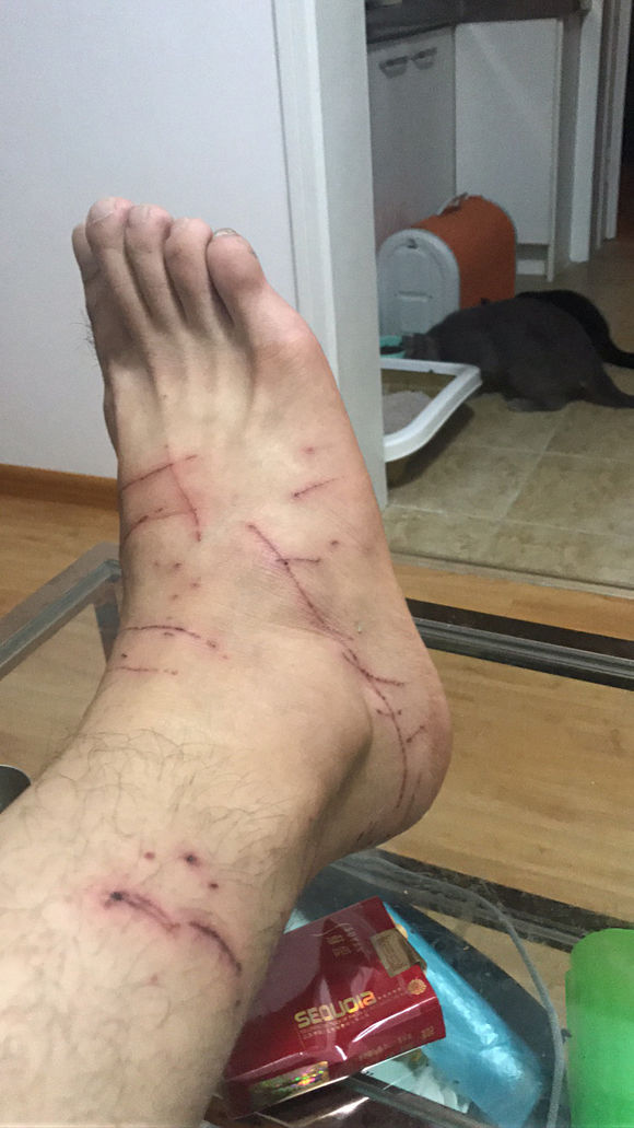 男子晒出被猫妈抓挠的伤痕，网友看后一阵大笑：没咬你算轻的！