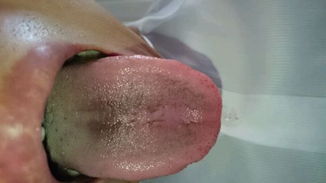 舌头有什么病检查什么,舌头有问题是怎么回事