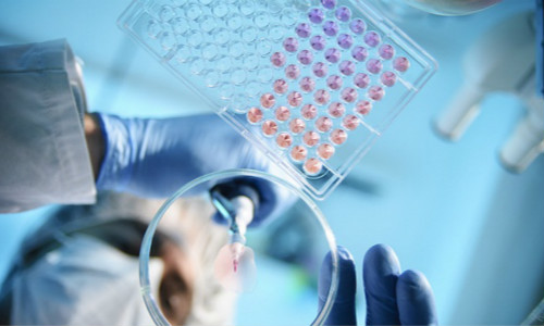 肾病患者吃了激素跟没吃一样,这是怎么回事?