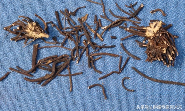 抗食道癌四大神草,食管癌最怕的一种中药