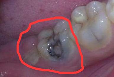 娌荤枟鐗欓緢鑲跨棝鐨勫皬鏂规硶,鐗欓緢鑲跨棝鎬庝箞鏀捐娌荤枟