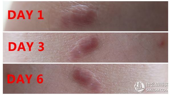 家庭医护小药箱,家庭急救小型药箱