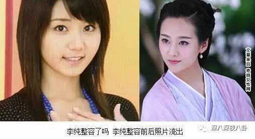 自从割双眼皮不算整容之后，娱乐圈不微调的女演员是真·不存在