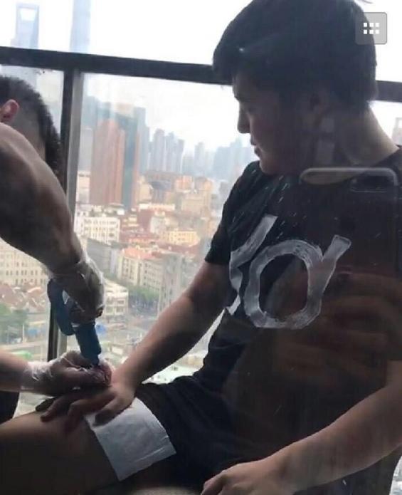 uzi治疗,uzi治疗手伤图