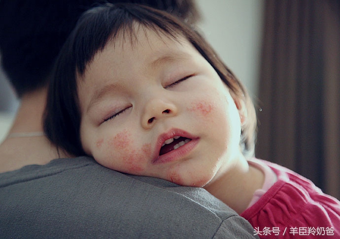 奶粉过敏的宝宝就不能吃奶粉了吗,宝宝喝奶粉过敏的原因及解决方法
