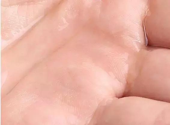 去黑头小妙招你的黑头有救了,别挤了教你去黑头的正确方法