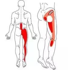 最粗长的针刀治疗女性坐骨神经痛,梨状肌导致的坐骨神经痛怎么治疗