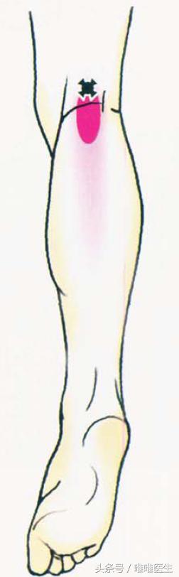 膝关节科普文章,膝关节疼痛最全解析