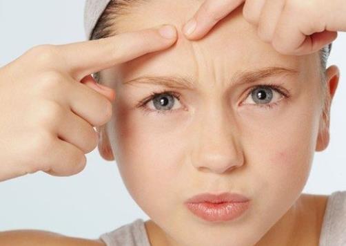 皮肤科医生推荐的淡化痘印方法,痘印顽固不化的原因