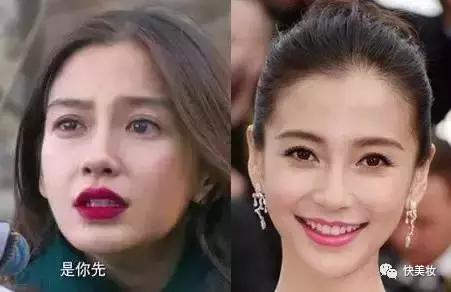 总被说牙齿黄,牙齿很黄是不是很讨人厌