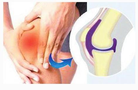 膝盖滑膜炎5天自愈方法,小儿膝盖滑膜炎一般多久能自愈