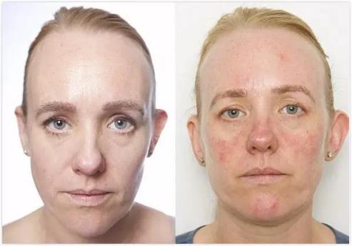 雪美清杨桃卸妆水有酒精味,雪美清杨桃收敛水成分