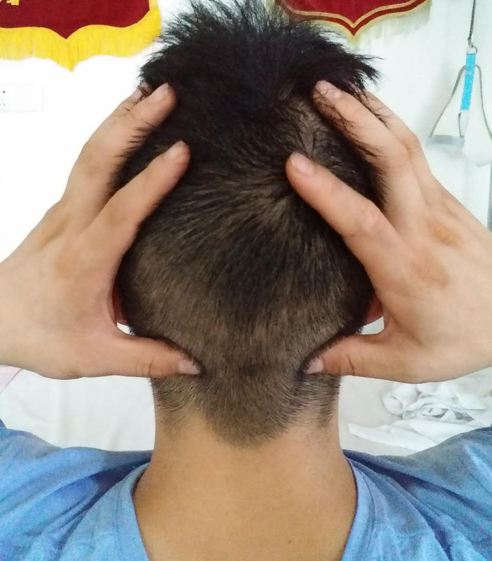 颈椎病头昏怎么做康复训练,颈椎病物理康复训练