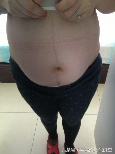 生男生女不求人,b超怎么看出胎儿姓名