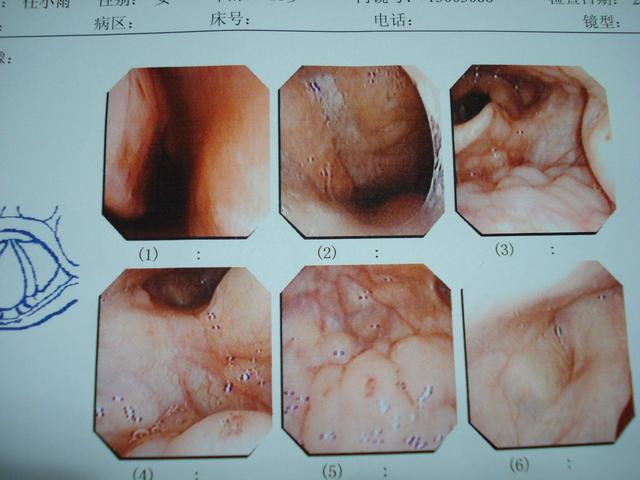 八个月宝宝头肿了,八个月宝宝头部突然红肿