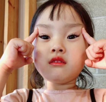 脸部水肿怎么消肿最快方法,脸部和眼睛水肿怎么办