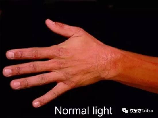 它是夜店的焦点，时尚的宠儿，医院……的心病……