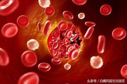 难道得了白癜风就找不到工作了吗,白癜风为什么不能晒太阳治疗