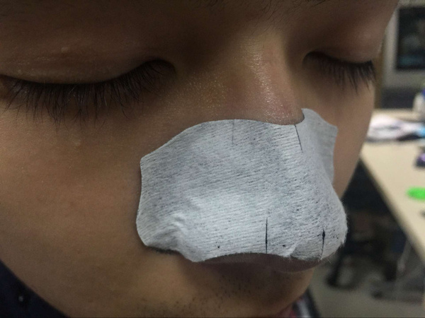 男士去除黑头,男士如何去除黑头的最有效方法