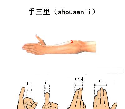 中医治疗疼痛的针灸方法,针灸治疗各种疼痛的穴位