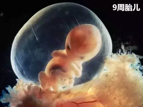 男的会接受女朋友打胎吗,你会建议你的女朋友打胎吗