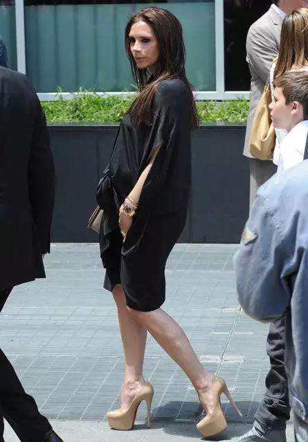 贝克汉姆老婆脚外翻,贝克汉姆老婆的脚拇外翻