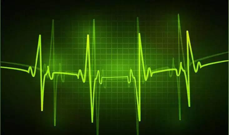 室性心动过速射频消融术风险大吗,射频消融治疗特发性左室心动过速