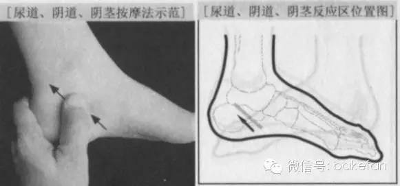 足部子宫反射区出问题怎么治疗,妇科脚底穴位反射区在哪图片