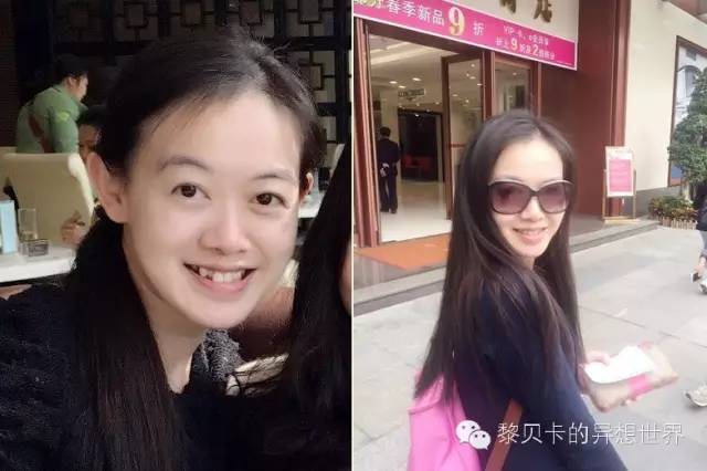 她们说||那些年整牙吞下的血和泪,终于换来最开怀的大笑