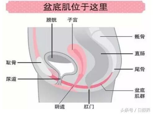 kegel盆底康复仪培训,kegel盆底康复仪使用方法