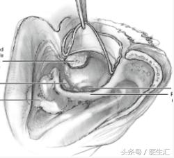 听力低频下降怎么恢复,低频听力下降耳鸣怎么治疗