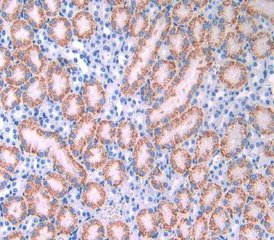 肾病治疗难易程度大排名，你会排第几呢？第一有点惨！