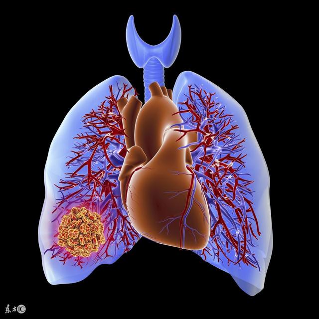 肺腺癌不能手术靶向治疗怎么样,肺腺癌转移到胸膜可以手术治疗吗